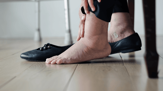 Do you suffer from fluid retention? We give you tips to avoid it! - Alkanatur North America